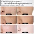 Anti-aging hudplejemaske med digital styring - sort