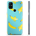 OnePlus Nord N10 5G TPU Cover - Bananer